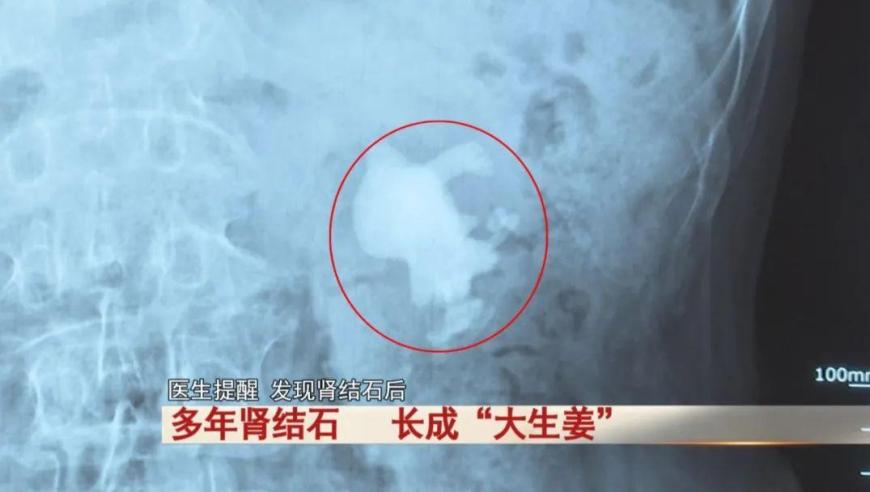 2025年香港开奖历史记录结果查询,雷军：要让喜欢SU7 Ultra的人买得起,确保成语解释落实的问题_扩展版V11.90